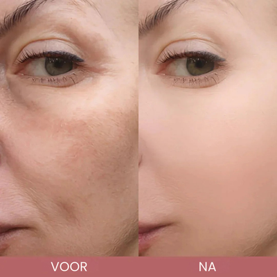 CocoBeauty Peel Shot Glow Rijst Ampoule