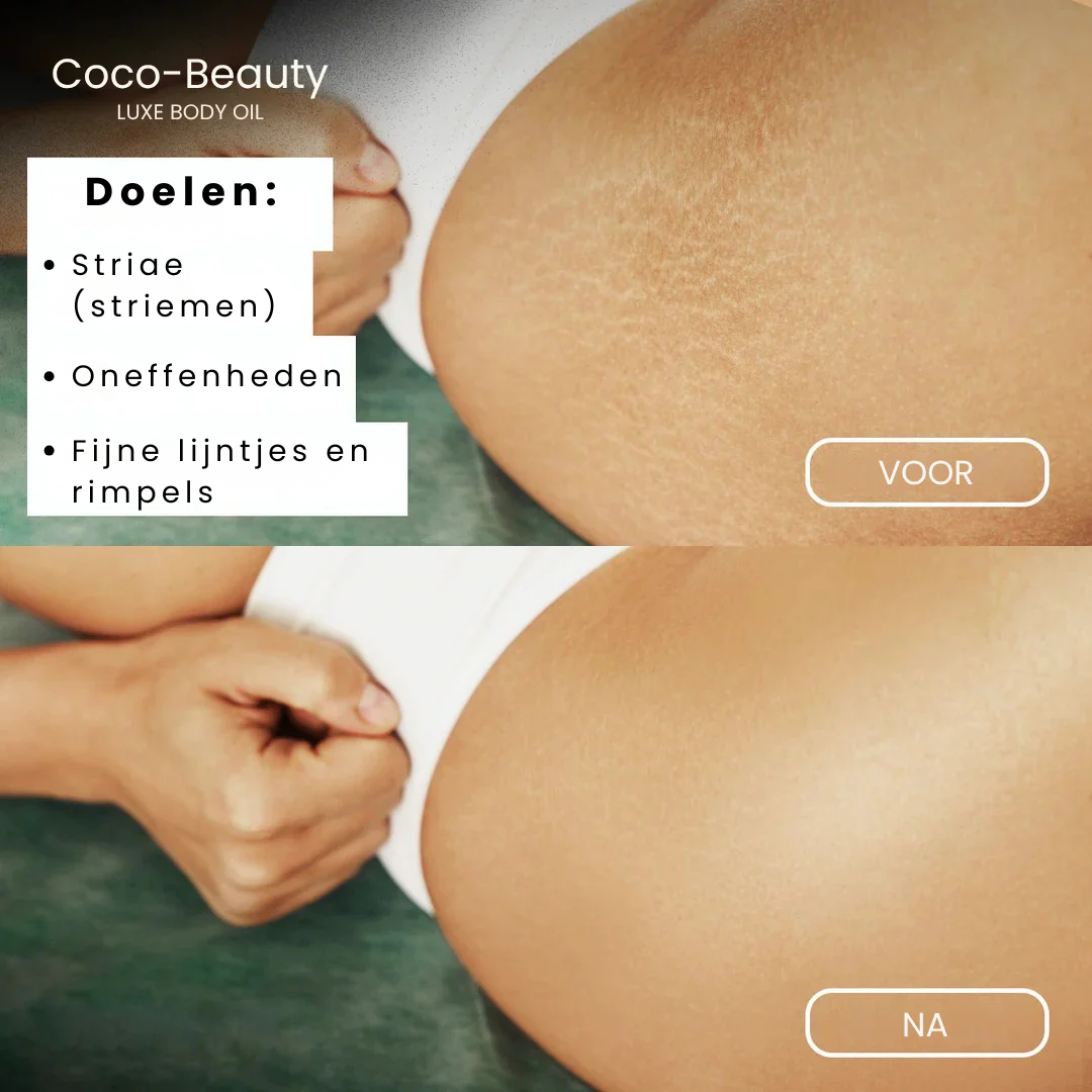 Coco™ Magic Body Oil - 2+1 GRATIS