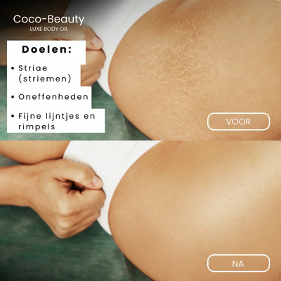Coco™ Magic Body Oil - 2+1 GRATIS