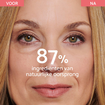 Coco anti wallen – Directe Effect Crème