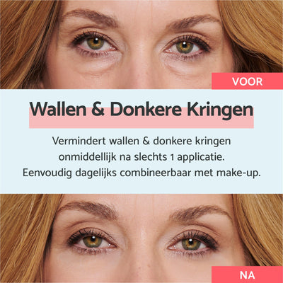 Coco anti wallen – Directe Effect Crème
