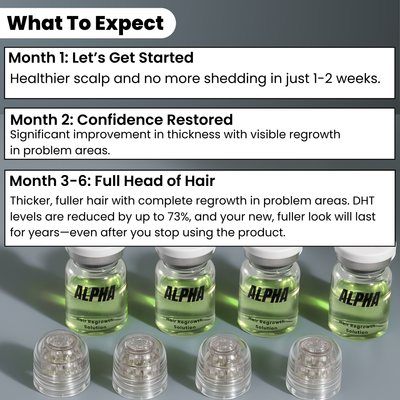 AlphaInfuse™ Haargroei Systeem